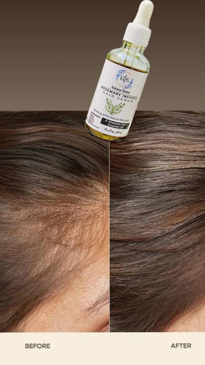 Pure Rosemary infused Serum - Stops Hair Fall